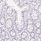 Immunohistochemical staining of human colon shows low expression as expected.