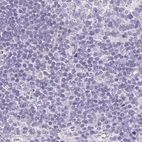 Immunohistochemical staining of human lymph node using Anti-CTRL antibody HPA034504.