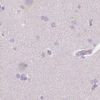 Immunohistochemical staining of human cerebral cortex using Anti-CTRL antibody HPA034504.