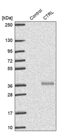 Western blot analysis in control (vector only transfected HEK293T lysate) and CTRL over-expression lysate (Co-expressed with a C-terminal myc-DDK tag (~3.1 kDa) in mammalian HEK293T cells, LY419665).