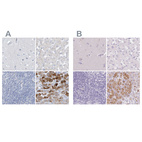 Immunohistochemical staining of human cerebral cortex, liver, lymph node and pancreas using Anti-CTRL antibody HPA034505 (A) shows similar protein distribution across tissues to independent antibody HPA034504 (B).