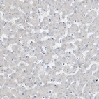 Immunohistochemical staining of human liver shows low expression as expected.