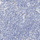 Immunohistochemical staining of human lymph node using Anti-CTRL antibody HPA034505.