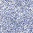 Immunohistochemical staining of human lymph node using Anti-CTRL antibody HPA034505.
