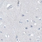 Immunohistochemical staining of human cerebral cortex using Anti-CTRL antibody HPA034505.