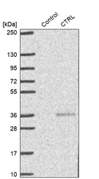 Western blot analysis in control (vector only transfected HEK293T lysate) and CTRL over-expression lysate (Co-expressed with a C-terminal myc-DDK tag (~3.1 kDa) in mammalian HEK293T cells, LY419665).