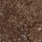 Immunohistochemical staining of human tonsil shows strong cytoplasmic positivity in non-germinal center cells and germinal center cells.