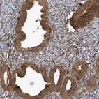 Immunohistochemical staining of human endometrium shows strong cytoplasmic positivity in glandular cells.