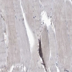 Immunohistochemical staining of human skeletal muscle shows no cytoplasmic positivity in myocytes as expected.