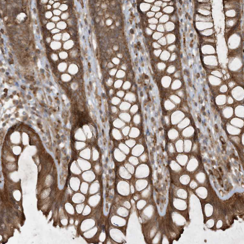 Anti-DDIT4 Antibody