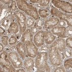 Immunohistochemical staining of human kidney shows moderate cytoplasmic positivity in cells in tubules.