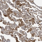 Immunohistochemical staining of human lung shows moderate cytoplasmic positivity in macrophages.