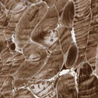 Immunohistochemical staining of human skeletal muscle shows strong cytoplasmic positivity in myocytes.