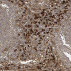 Immunohistochemical staining of human lymph node shows strong cytoplasmic positivity in a subset of non-germinal center cells.