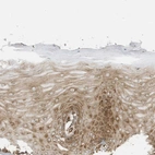 Immunohistochemical staining of human cervix shows moderate cytoplasmic positivity in squamous epithelial cells.