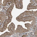 Immunohistochemical staining of human Fallopian tube shows moderate cytoplasmic positivity in glandular cells.