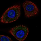 Immunofluorescent staining of human cell line hTCEpi shows localization to cytosol.