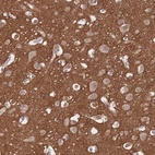 Immunohistochemical staining of human cerebral cortex shows high expression.