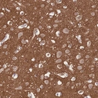 Immunohistochemical staining of human cerebral cortex shows high expression.