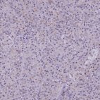 Anti-ADD2 Antibody