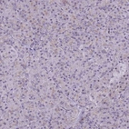 Immunohistochemical staining of human pancreas shows low expression as expected.