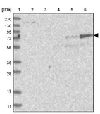 Lane 1: Marker [kDa] 230, 130, 95, 72, 56, 36, 28, 17, 11_br/_Lane 2: Human cell line RT-4_br/_Lane 3: Human cell line U-251MG sp_br/_Lane 4: Human plasma (IgG/HSA depleted)_br/_Lane 5: Human liver tissue_br/_Lane 6: Human tonsil tissue