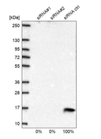 Western blot analysis in U2OS cells transfected with control siRNA, target specific siRNA probe #1 and #2, using Anti-COX5B antibody. Remaining relative intensity is presented