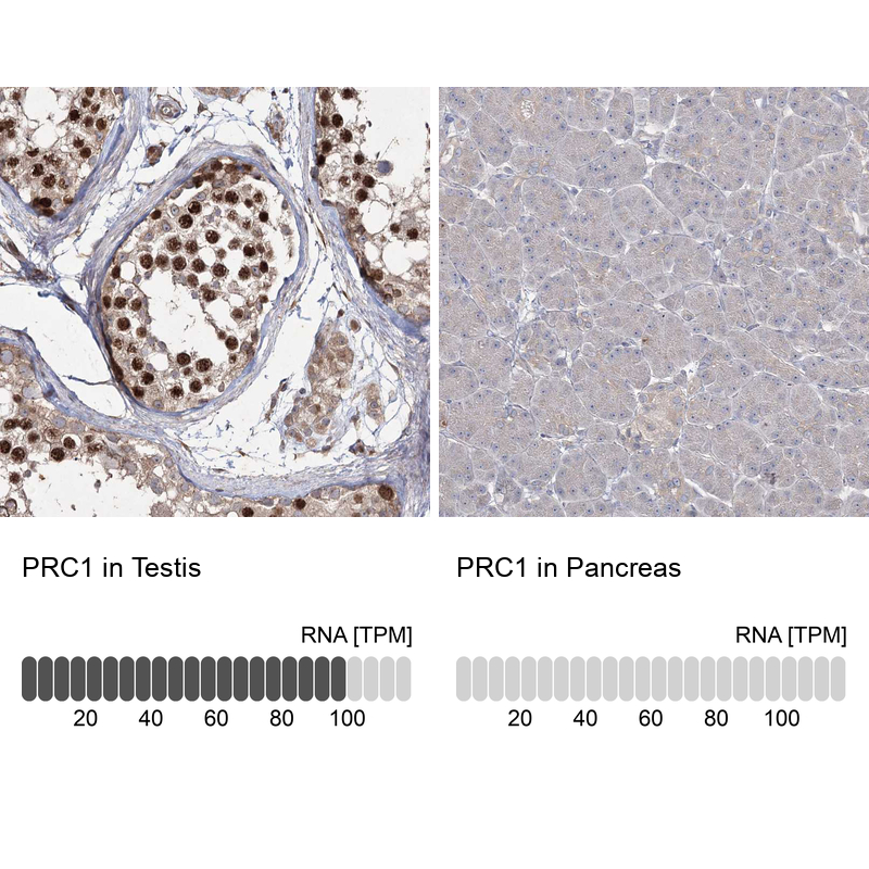 Anti-PRC1 Antibody