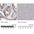 Anti-PRC1 Antibody