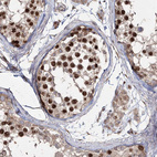 Immunohistochemical staining of human testis shows strong nuclear positivity in cells in seminiferous ducts.