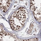 Immunohistochemical staining of human testis shows strong nuclear positivity in cells in seminiferous ducts.