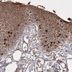 Immunohistochemical staining of human skin shows strong cytoplasmic positivity in epidermal cells.