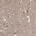 Immunohistochemical staining of human cerebral cortex shows moderate positivity in nuclear membrane in neurons.