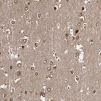 Immunohistochemical staining of human cerebral cortex shows moderate positivity in nuclear membrane in neurons.