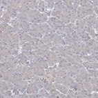 Immunohistochemical staining of human pancreas shows no positivity in exocrine glandular cells as expected.