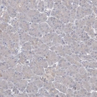 Immunohistochemical staining of human pancreas shows no positivity in exocrine glandular cells as expected.