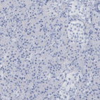 Anti-PTPRO Antibody