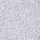 Anti-PTPRO Antibody