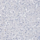 Immunohistochemical staining of human liver shows no positivity in hepatocytes as expected.