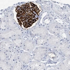 Immunohistochemical staining of human kidney shows strong membranous positivity in cells in glomeruli.