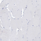 Immunohistochemical staining of human skeletal muscle shows no positivity in myocytes as expected.