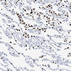 Immunohistochemical staining of human lung shows strong nuclear positivity in macrophages.