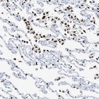 Immunohistochemical staining of human lung shows strong nuclear positivity in macrophages.