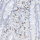 Immunohistochemical staining of human colon shows strong nuclear positivity in lymphoid cells.