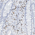 Immunohistochemical staining of human colon shows strong nuclear positivity in lymphoid cells.