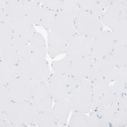 Immunohistochemical staining of human skeletal muscle shows no positivity in myocytes as expected.