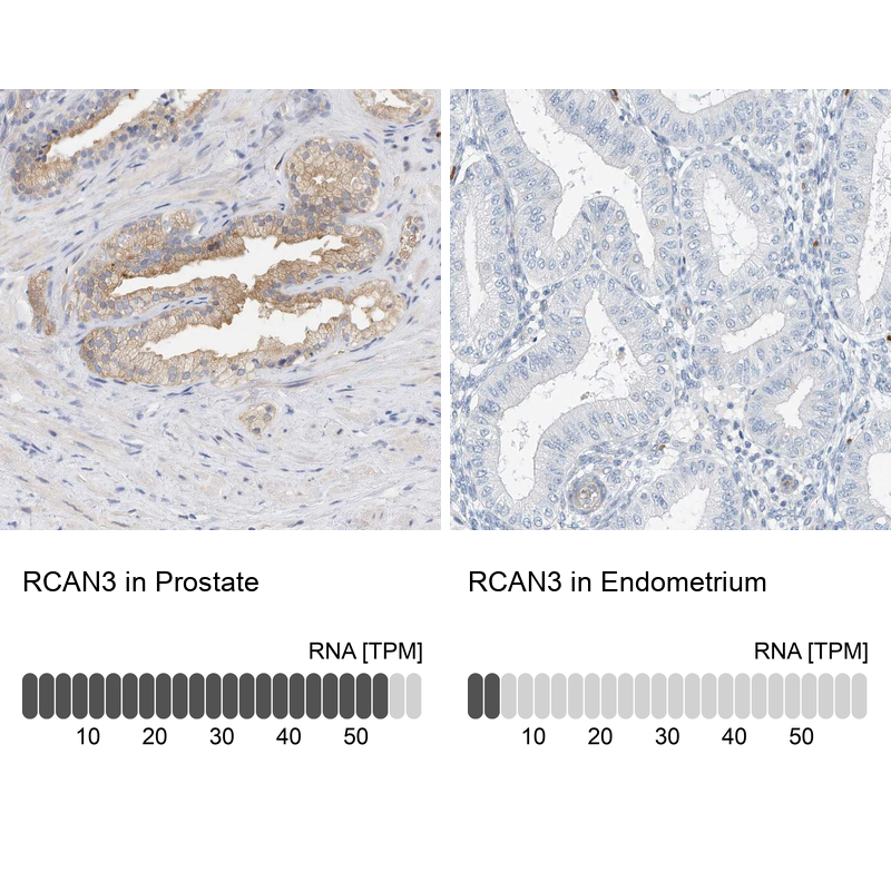Anti-RCAN3 Antibody