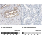 Anti-RCAN3 Antibody
