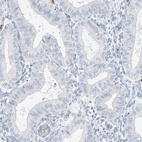 Immunohistochemical staining of human endometrium shows low expression as expected.