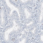 Anti-RCAN3 Antibody